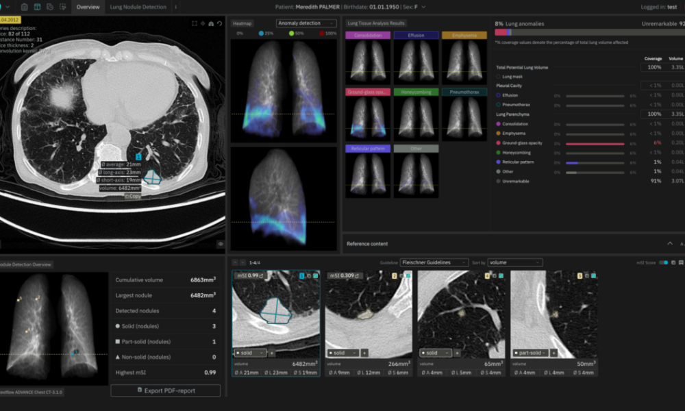 ai’s-role-in-medical-imaging-for-earlier-anomaly-detection