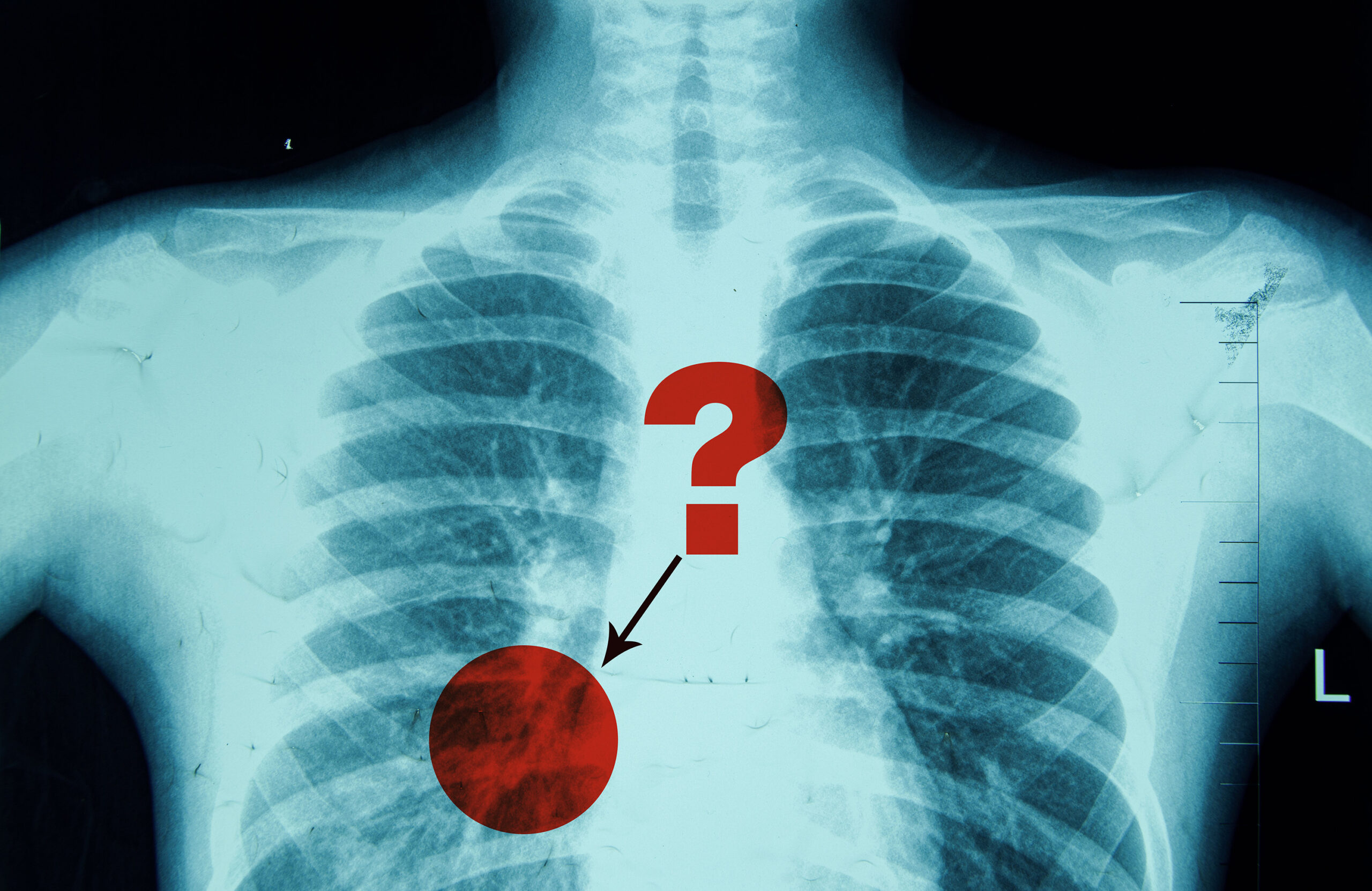 new-method-assesses-and-improves-the-reliability-of-radiologists’-diagnostic-reports