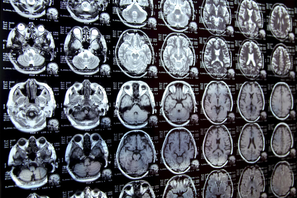 new-ai-system-could-accelerate-clinical-research