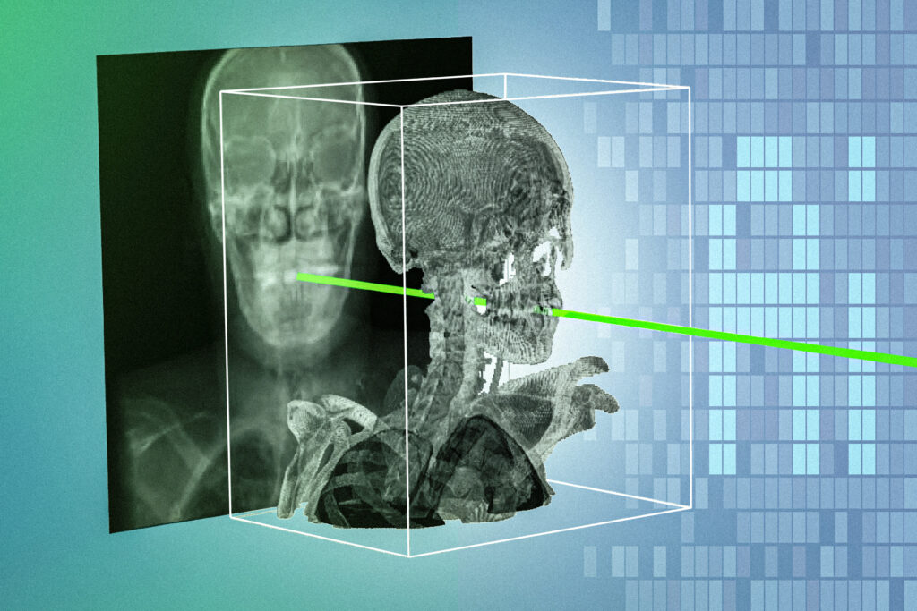 new-ai-technique-could-make-minimally-invasive-surgeries-safer-and-more-precise